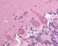 ADD1 Antibody (Ser726)
